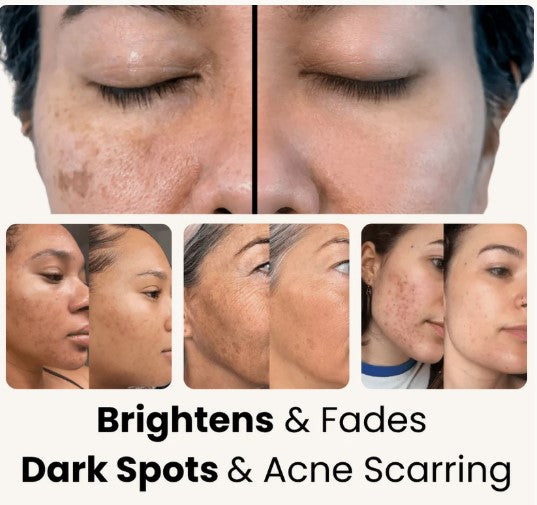 BAIDLEE™ Turmeric and Kojic Acid Pads