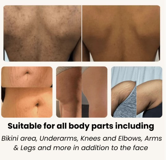 BAIDLEE™ Turmeric and Kojic Acid Pads