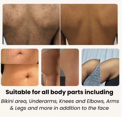 BAIDLEE™ Turmeric and Kojic Acid Pads