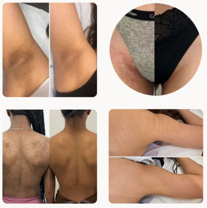 BAIDLEE™ Turmeric and Kojic Acid Pads