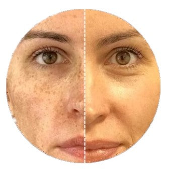 Dark Spots